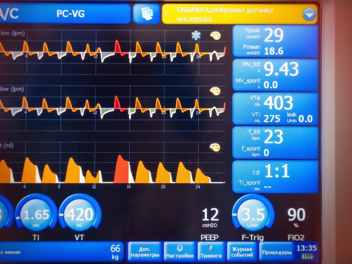 Ventilateur médical